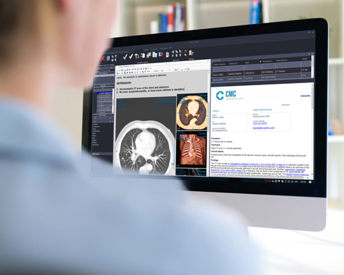 Doctora que utiliza el visor diagn&oacute;stico para examinar im&aacute;genes de RM con perfusi&oacute;n