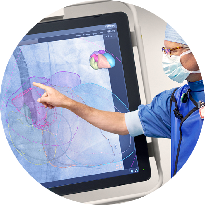 Cardi&oacute;logo intervencionista analiza el tratamiento de cardiopat&iacute;as estructurales