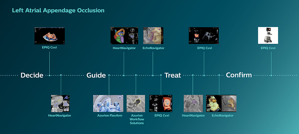 Oclusi&oacute;n de la orejuela izquierda