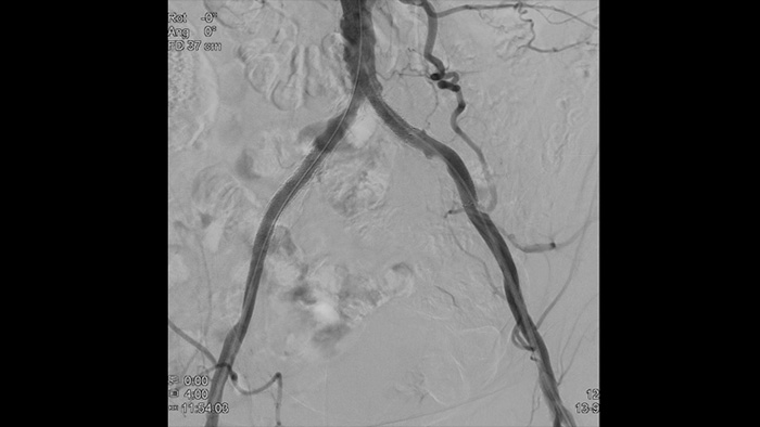 Gu&iacute;a de im&aacute;genes en vivo con tecnolog&iacute;a ClarityIQ