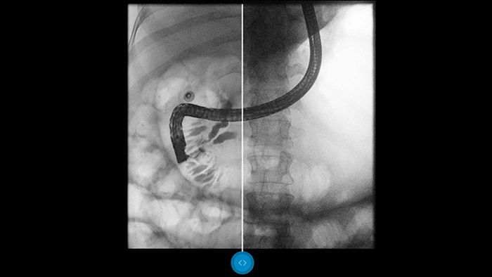 Descubra c&oacute;mo funciona Dynamic UNIQUE