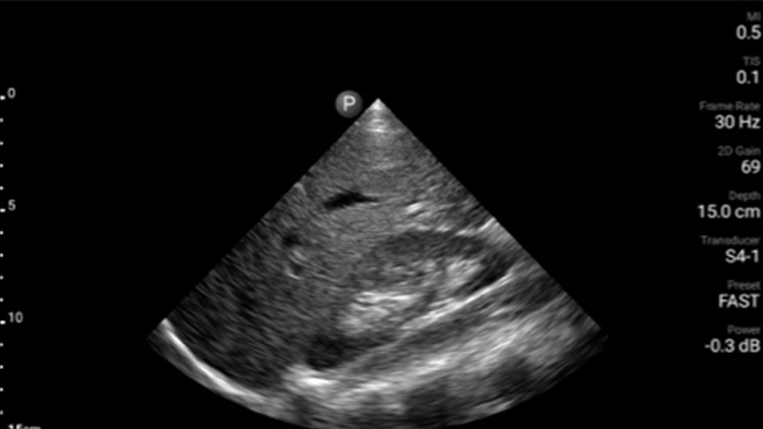 imagen en miniatura del h&iacute;gado y ri&ntilde;&oacute;n