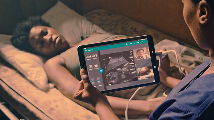 Lumify con Reacts, aplicaci&oacute;n de ultrasonido port&aacute;til