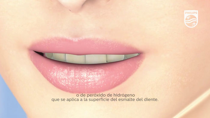 V&iacute;deo de la ciencia detr&aacute;s del blanqueamiento Philips Zoom! 