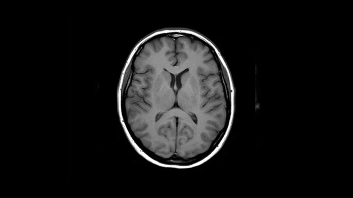 Imagen cl&iacute;nica cerebral