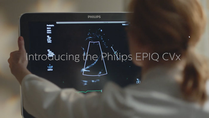 Soluci&oacute;n de ecocardiograf&iacute;a EPIQ&nbsp;CVx