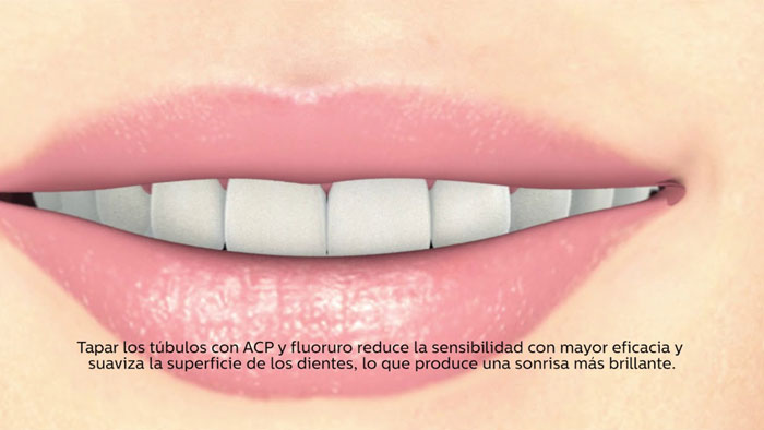 V&iacute;deo del tratamiento para la sensibilidad y su prevenci&oacute;n