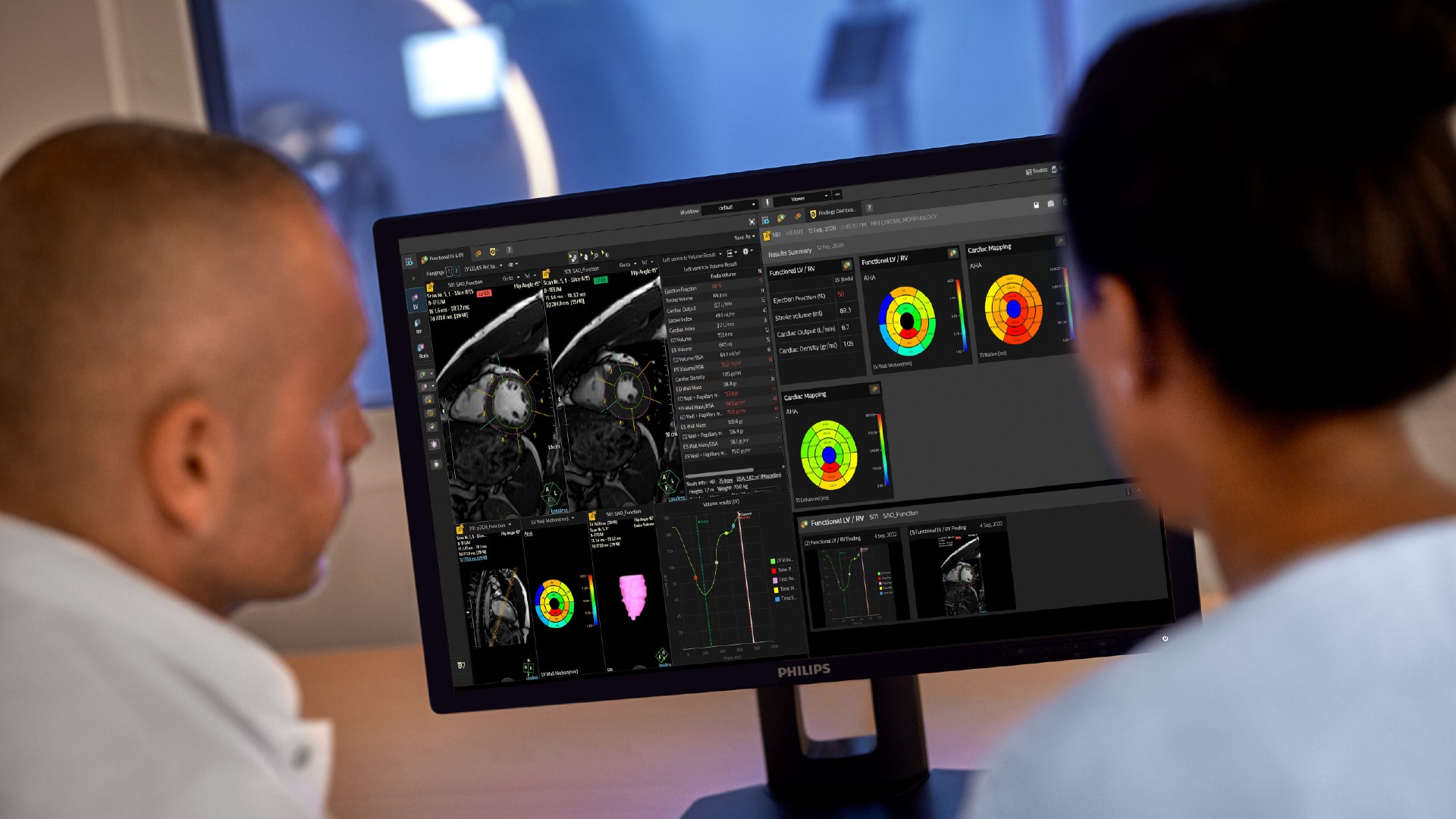 Philips celebra 90 a&ntilde;os en Argentina innovando para cuidar y mejorar la vida de las personas