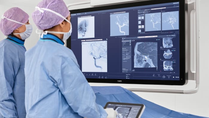 Philips est&aacute; priorizando la atenci&oacute;n del accidente cerebro vascular a nivel mundial.